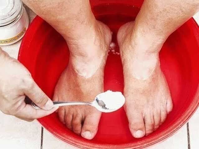 sódové kúpele na huby