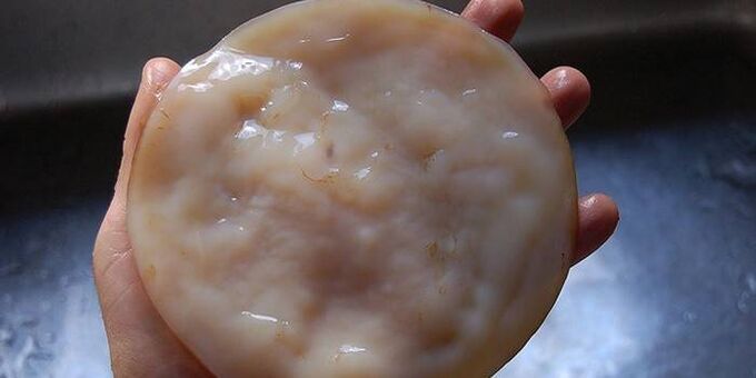 Kombucha na pleseň nechtov